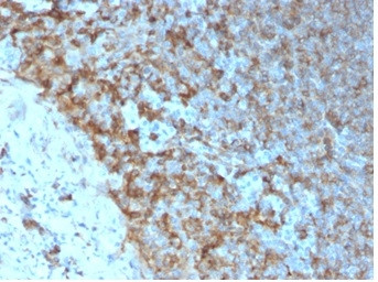 HLA-Pan (MHC II) Antibody in Immunohistochemistry (Paraffin) (IHC (P))