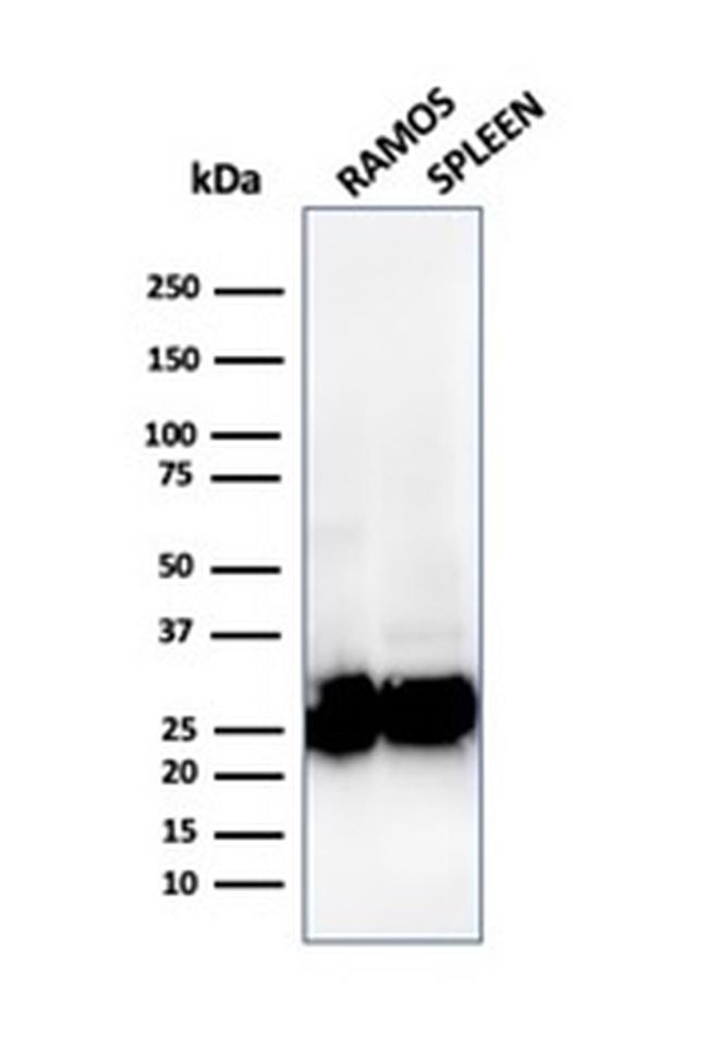 HLA-Pan (MHC II) Antibody in Western Blot (WB)