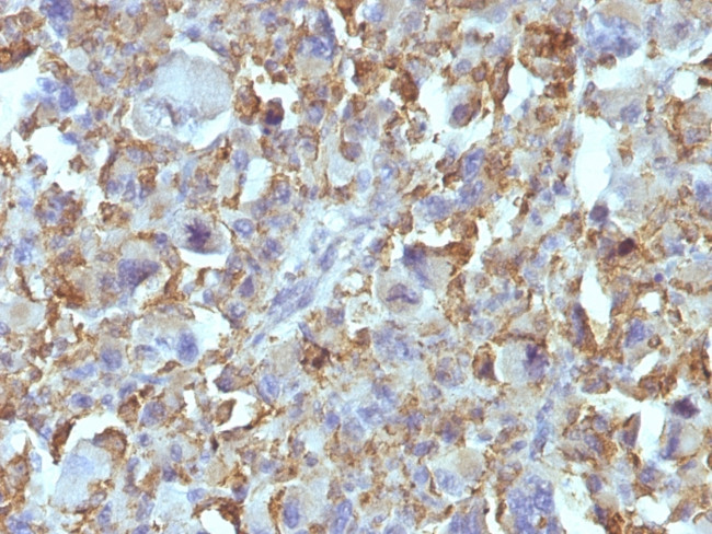 Macrophage and Histiocytoma Marker Antibody in Immunohistochemistry (Paraffin) (IHC (P))