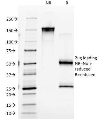 Macrophage and Histiocytoma Marker Antibody in SDS-PAGE (SDS-PAGE)