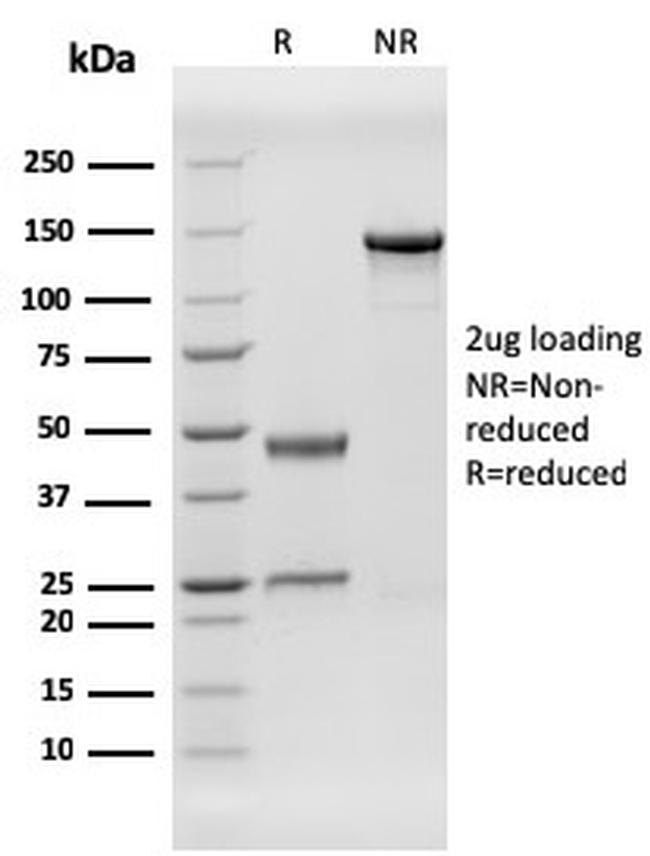 Human Herpes Virus 8 (HHV8) Antibody in SDS-PAGE (SDS-PAGE)