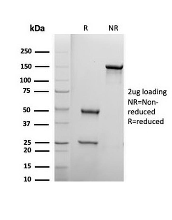 Biotin (Vitamin B7 or Vitamin H) Antibody in SDS-PAGE (SDS-PAGE)