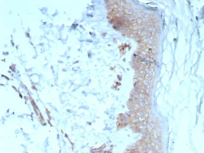 Pan-Cadherin Antibody in Immunohistochemistry (Paraffin) (IHC (P))