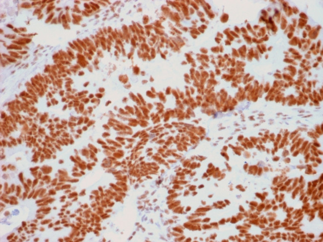 Human Nucleolar Antigen Antibody in Immunohistochemistry (Paraffin) (IHC (P))