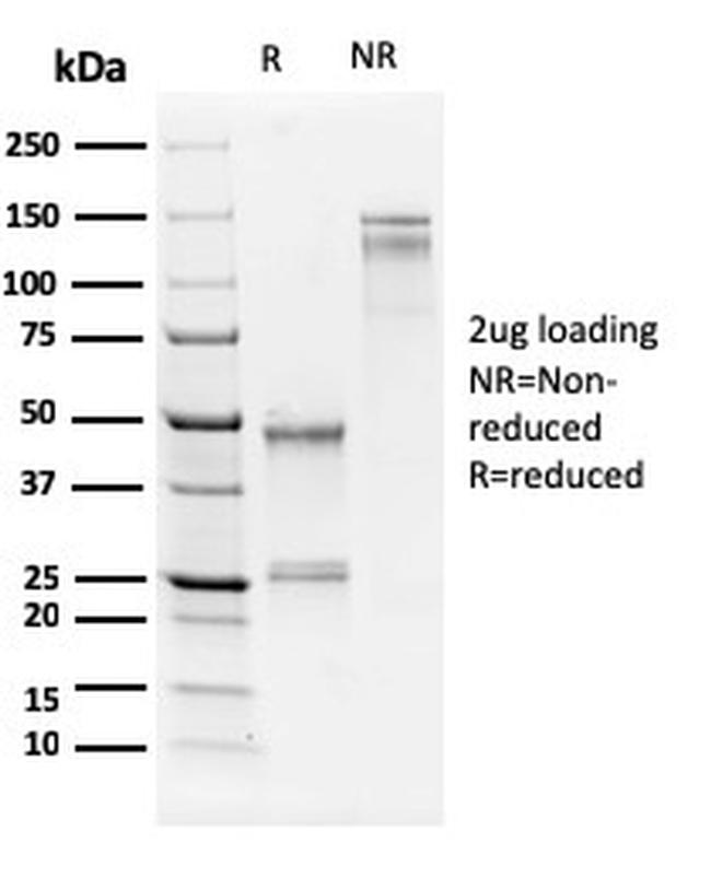 Human Nucleolar Antigen Antibody in SDS-PAGE (SDS-PAGE)