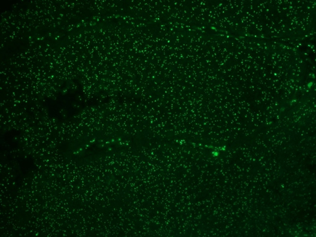 Human Nucleolar Antigen Antibody in Immunohistochemistry (Paraffin) (IHC (P))