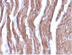 Actin, Muscle Specific (Muscle Cell Marker) Antibody in Immunohistochemistry (Paraffin) (IHC (P))