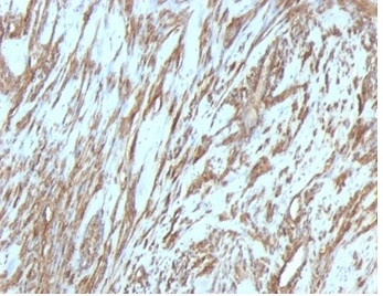 Actin, Muscle Specific (Muscle Cell Marker) Antibody in Immunohistochemistry (Paraffin) (IHC (P))