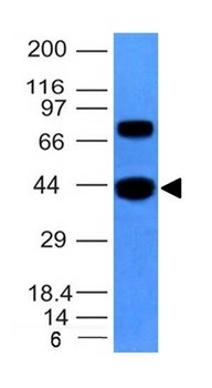 Actin, Muscle Specific (Muscle Cell Marker) Antibody in Western Blot (WB)