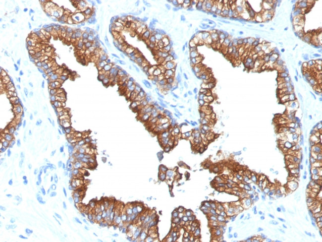 Cytokeratin 8/18 Antibody in Immunohistochemistry (Paraffin) (IHC (P))