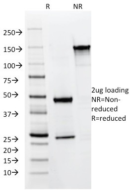 Cytokeratin 8/18 Antibody in SDS-PAGE (SDS-PAGE)