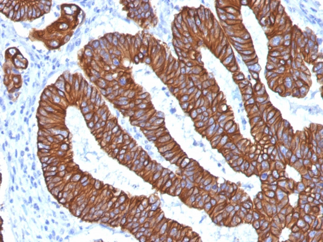 Cytokeratin 8/18 Antibody in Immunohistochemistry (Paraffin) (IHC (P))