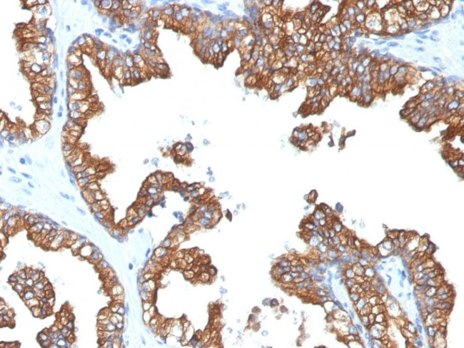 Cytokeratin 8/18 Antibody in Immunohistochemistry (Paraffin) (IHC (P))