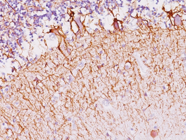 Neurofilament (H+L) (Neuronal Marker) Antibody in Immunohistochemistry (Paraffin) (IHC (P))