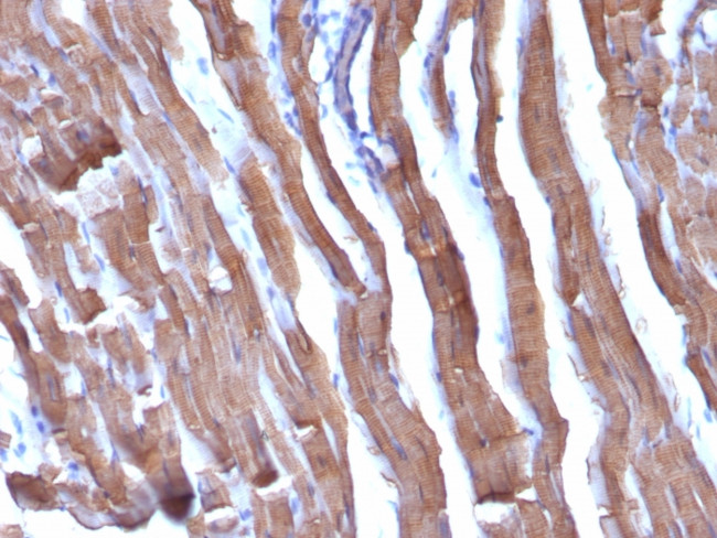 Actin, Muscle Specific (Muscle Cell Marker) Antibody in Immunohistochemistry (Paraffin) (IHC (P))