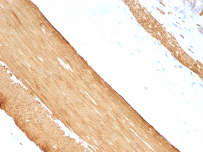 Actin, Muscle Specific (Muscle Cell Marker) Antibody in Immunohistochemistry (Paraffin) (IHC (P))