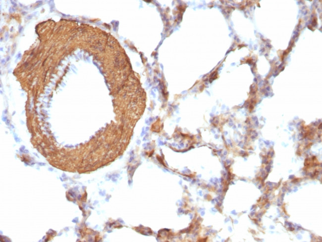 Actin, Muscle Specific (Muscle Cell Marker) Antibody in Immunohistochemistry (Paraffin) (IHC (P))