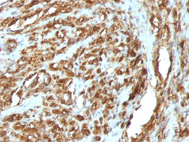 Actin, Muscle Specific (Muscle Cell Marker) Antibody in Immunohistochemistry (Paraffin) (IHC (P))