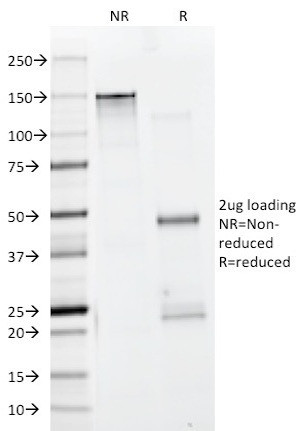 Actin, Muscle Specific (Muscle Cell Marker) Antibody in SDS-PAGE (SDS-PAGE)