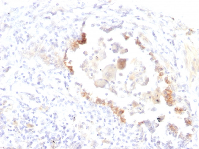 Lewis Y Antibody in Immunohistochemistry (Paraffin) (IHC (P))