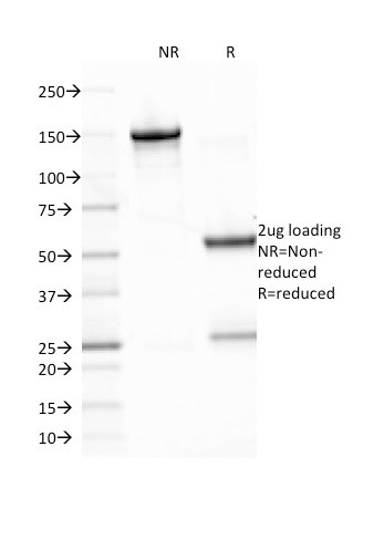 Epstein-Barr Virus (LMP-1) Antibody in SDS-PAGE (SDS-PAGE)