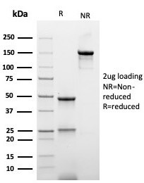 Hexa-histidine (Epitope Tag) Antibody in SDS-PAGE (SDS-PAGE)