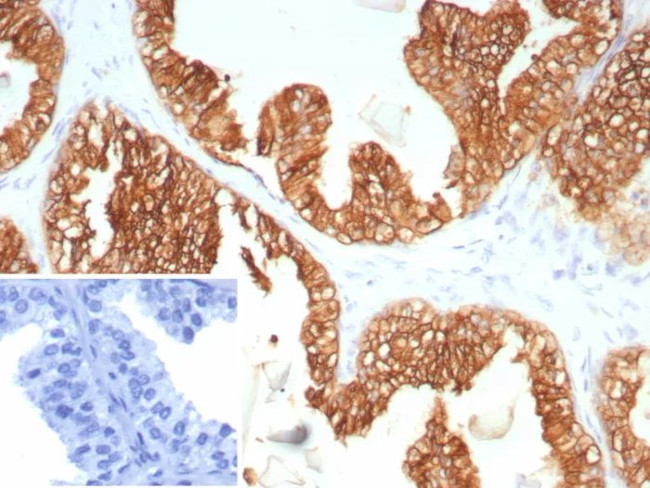 Cytokeratin 5/6 (Basal, Myoepithelial and Mesothelial Cell Marker) Antibody in Immunohistochemistry (Paraffin) (IHC (P))