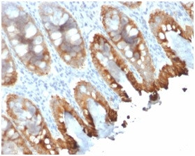 Cytokeratin 8/18 Antibody in Immunohistochemistry (Paraffin) (IHC (P))