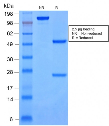 Cytokeratin 8/18 Antibody in SDS-PAGE (SDS-PAGE)