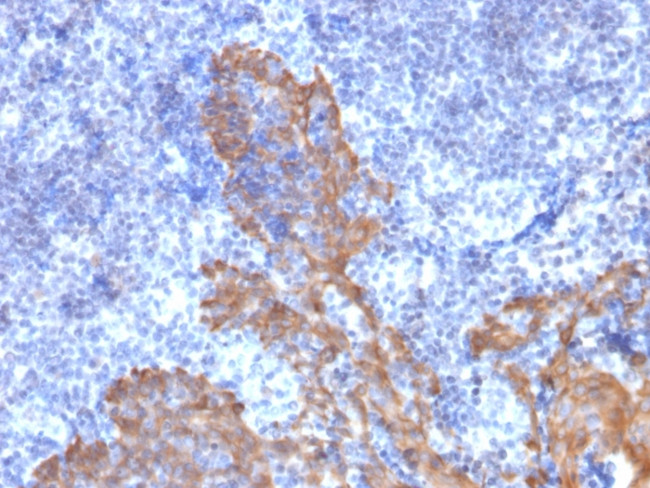 Cytokeratin 5/6 (Basal, Myoepithelial and Mesothelial Cell Marker) Antibody in Immunohistochemistry (Paraffin) (IHC (P))