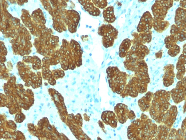 Cytokeratin 5/6 (Basal, Myoepithelial and Mesothelial Cell Marker) Antibody in Immunohistochemistry (Paraffin) (IHC (P))