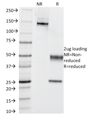 Cytokeratin 5/6 (Basal, Myoepithelial and Mesothelial Cell Marker) Antibody in SDS-PAGE (SDS-PAGE)