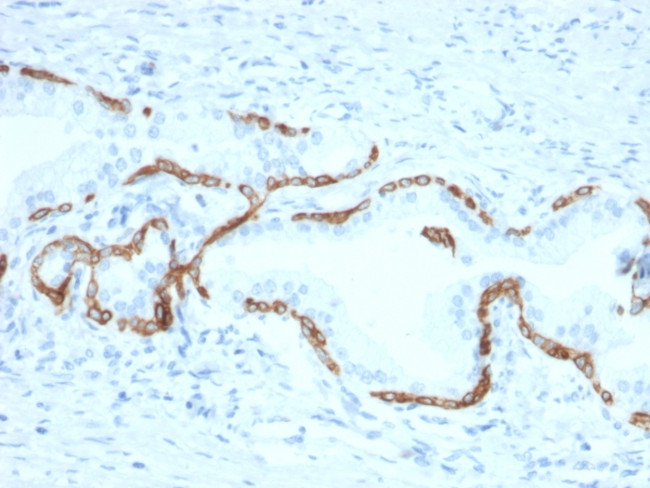 Cytokeratin 5/6 (Basal, Myoepithelial and Mesothelial Cell Marker) Antibody in Immunohistochemistry (Paraffin) (IHC (P))