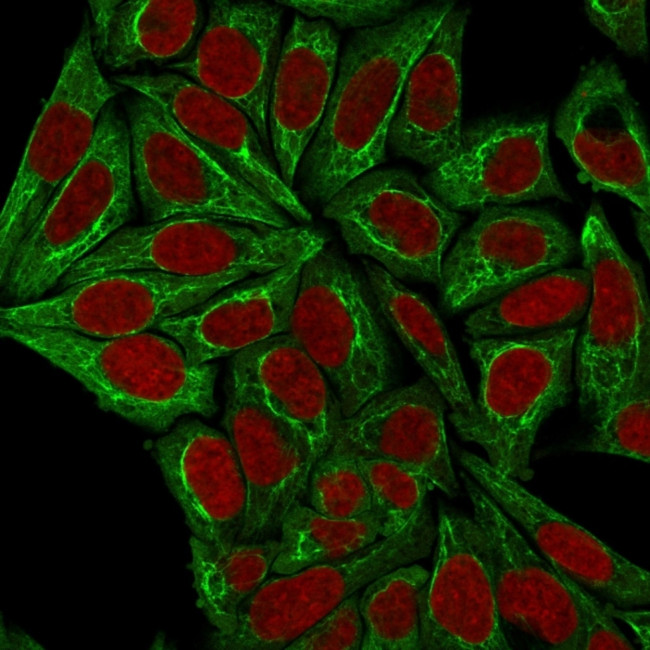 Cytokeratin, pan (Epithelial Marker) Antibody in Immunocytochemistry (ICC/IF)