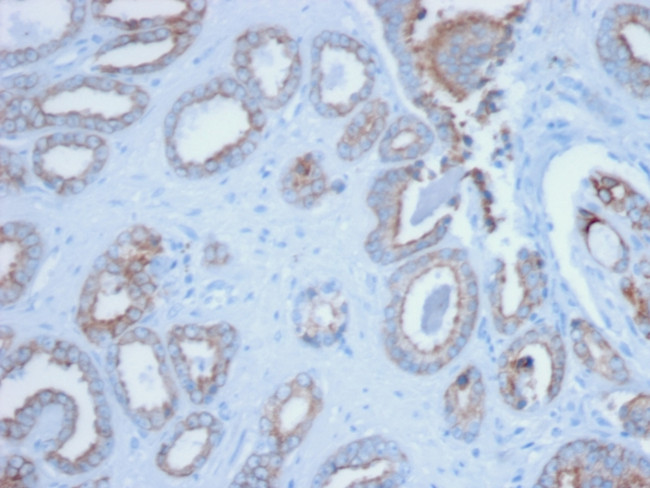 Cytokeratin, pan (Epithelial Marker) Antibody in Immunohistochemistry (Paraffin) (IHC (P))