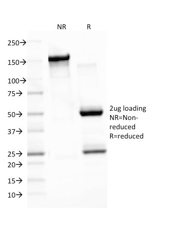 Epstein-Barr Virus (LMP-1) Antibody in SDS-PAGE (SDS-PAGE)