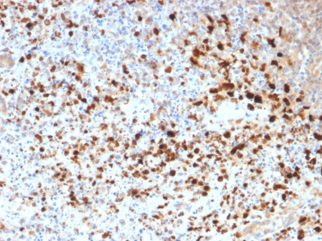 HSV1 (Herpes Simplex Virus Type I) Antibody in Immunohistochemistry (Paraffin) (IHC (P))