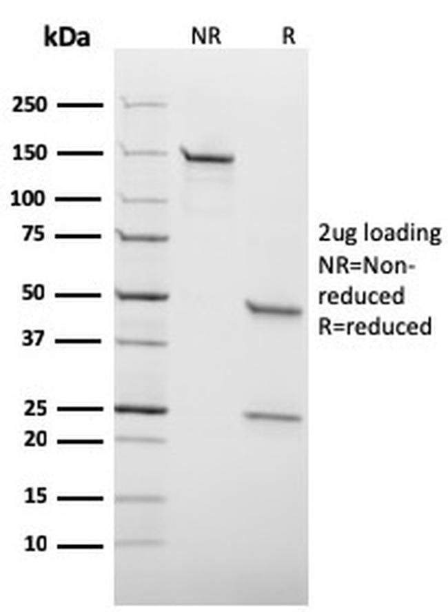 HSV1 (Herpes Simplex Virus Type I) Antibody in SDS-PAGE (SDS-PAGE)