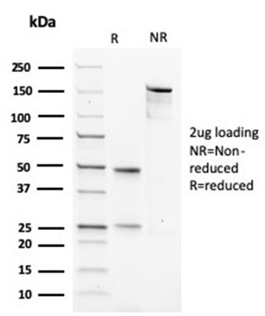 Actin, Muscle Specific (Muscle Cell Marker) Antibody in SDS-PAGE (SDS-PAGE)