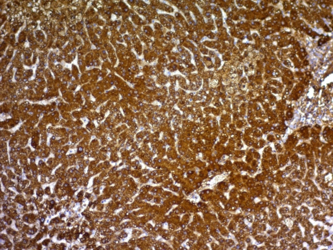 HepPar-1 Antibody in Immunohistochemistry (Paraffin) (IHC (P))