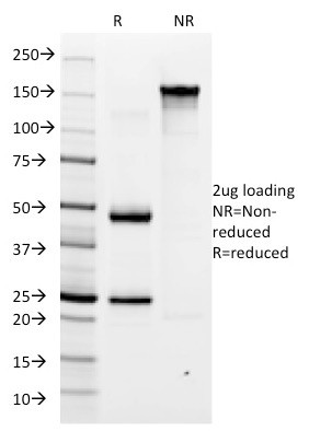 Helicobacter pylori Antibody in SDS-PAGE (SDS-PAGE)