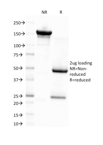 Epstein-Barr Virus (LMP-1) Antibody in SDS-PAGE (SDS-PAGE)