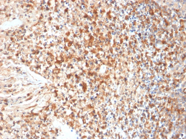 HSV1 (Herpes Simplex Virus Type I) Antibody in Immunohistochemistry (Paraffin) (IHC (P))