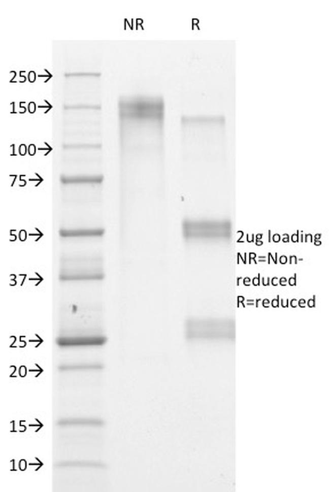 HSV1 (Herpes Simplex Virus Type I) Antibody in SDS-PAGE (SDS-PAGE)