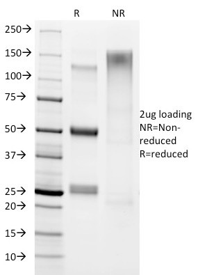 Helicobacter pylori Antibody in SDS-PAGE (SDS-PAGE)