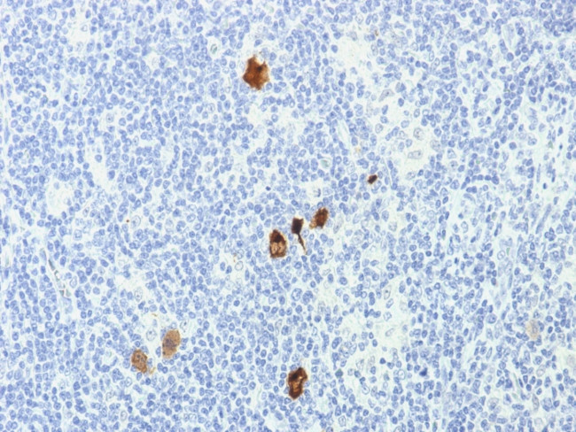 Epstein-Barr Virus (LMP-1) Antibody in Immunohistochemistry (Paraffin) (IHC (P))