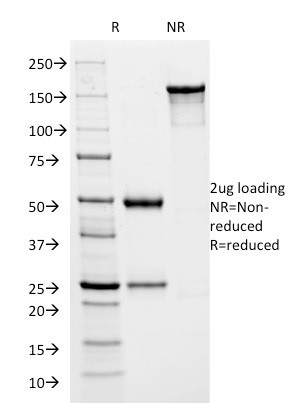 HSV1 (Herpes Simplex Virus Type I) ICP8 Antibody in SDS-PAGE (SDS-PAGE)