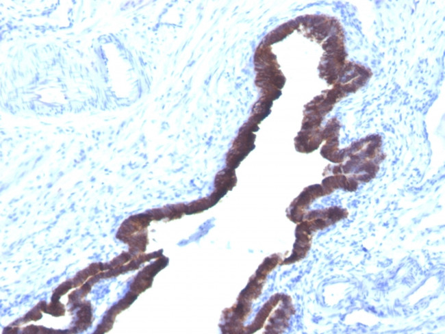 Cytokeratin 8/18 Antibody in Immunohistochemistry (Paraffin) (IHC (P))