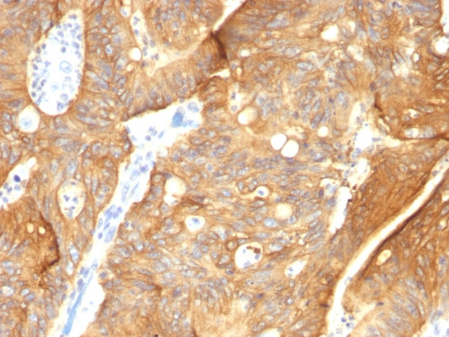 Cytokeratin 8/18 Antibody in Immunohistochemistry (Paraffin) (IHC (P))