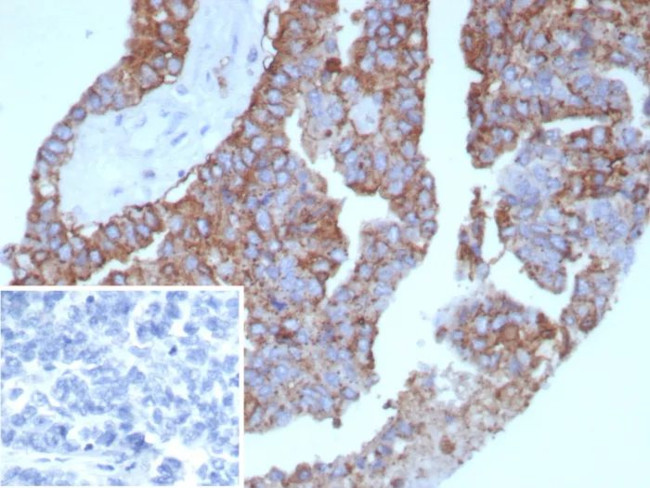 Pan-HLA-II (DP, DQ, DR) Antibody in Immunohistochemistry (Paraffin) (IHC (P))